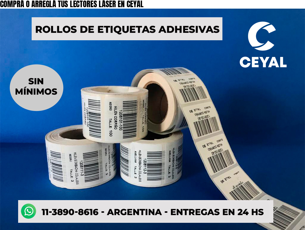 COMPRÁ O ARREGLÁ TUS LECTORES LÁSER EN CEYAL